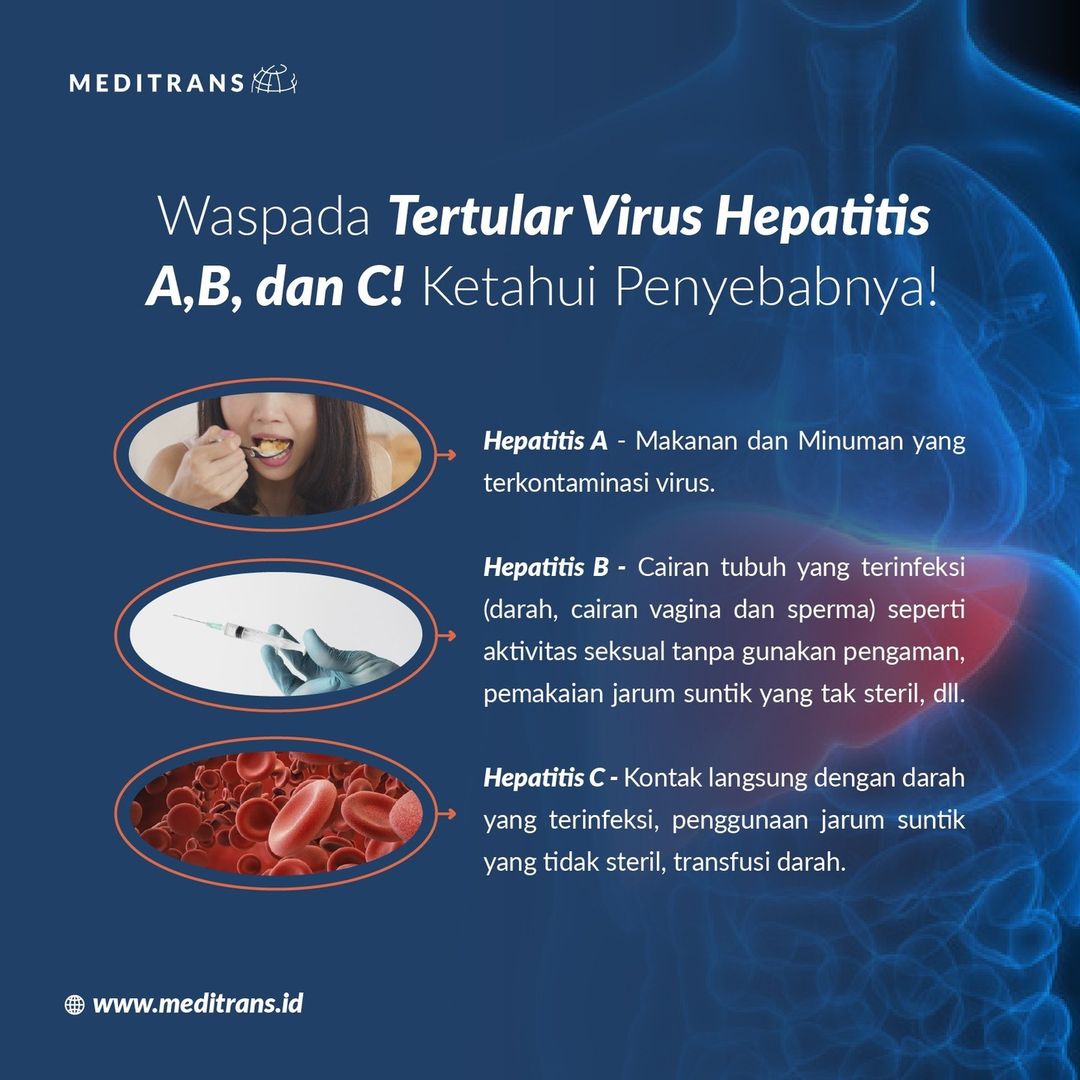 Waspada Tertular Hepatitis A, B, Dan C: Penyebab Dan Pencegahannya ...