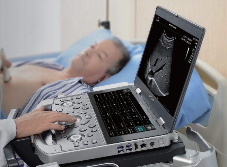 MX7 Portable Ultrasound System