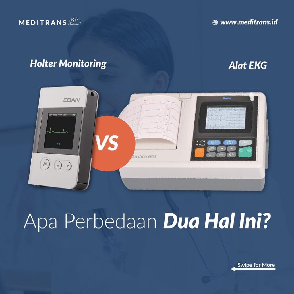 Holter Monitoring Dan EKG, Apasih Bedanya??