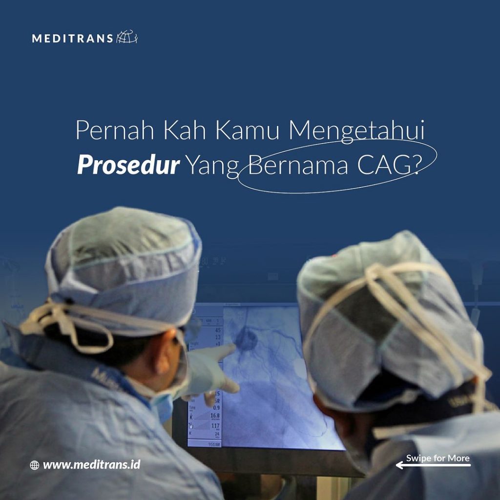 CAG: Prosedur Diagnostik Penting untuk Menentukan Kesehatan Jantung Anda!