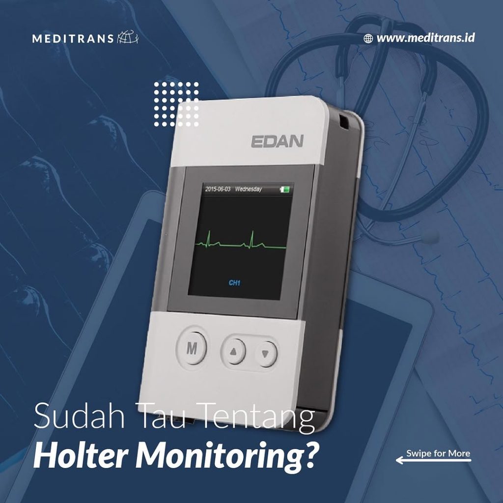 Memantau Irama Jantung Selama 24 Jam Dengan Holter Monitor