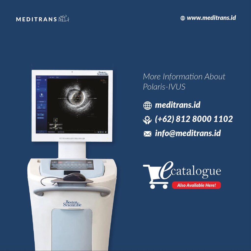 Kenapa IVUS Diperlukan pada Prosedur Pemasangan Ring Jantung?