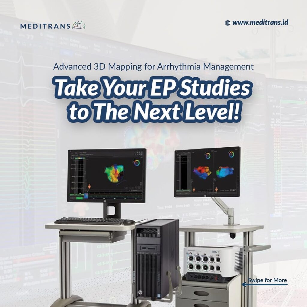 Tingkatkan Keakuratan Studi Elektrofisiologi dengan RHYTHMIA 3D Mapping!